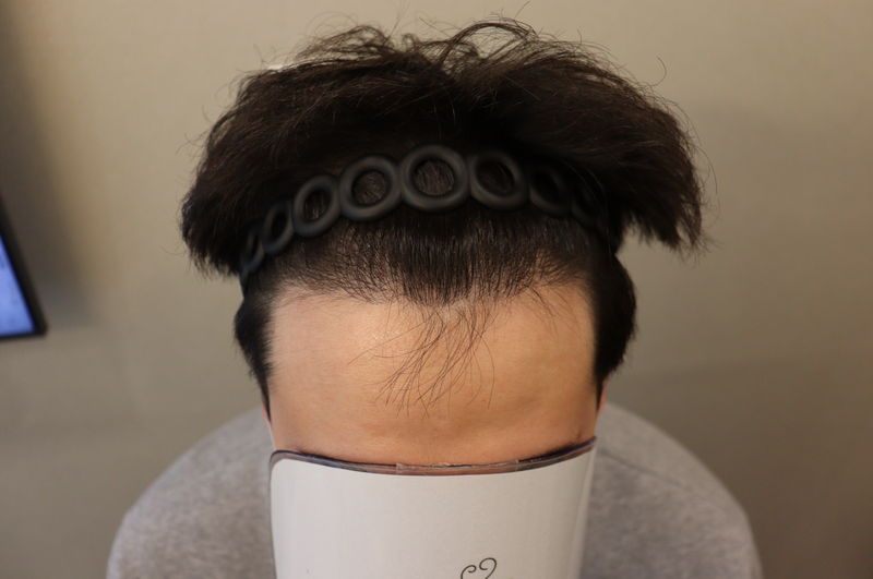 수술후 2.png