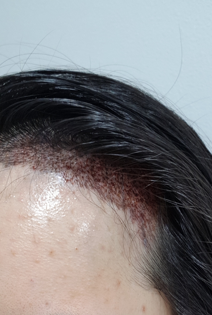 20190124_084432.jpg