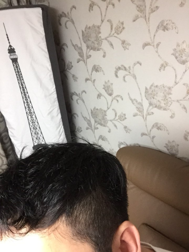 140일됐습니다.. 처음보단 나아진것 같기도 하고 아닌것 같기도 하고..
