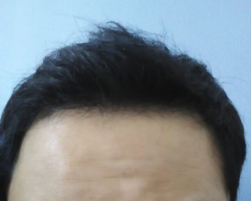 제목 없음.png