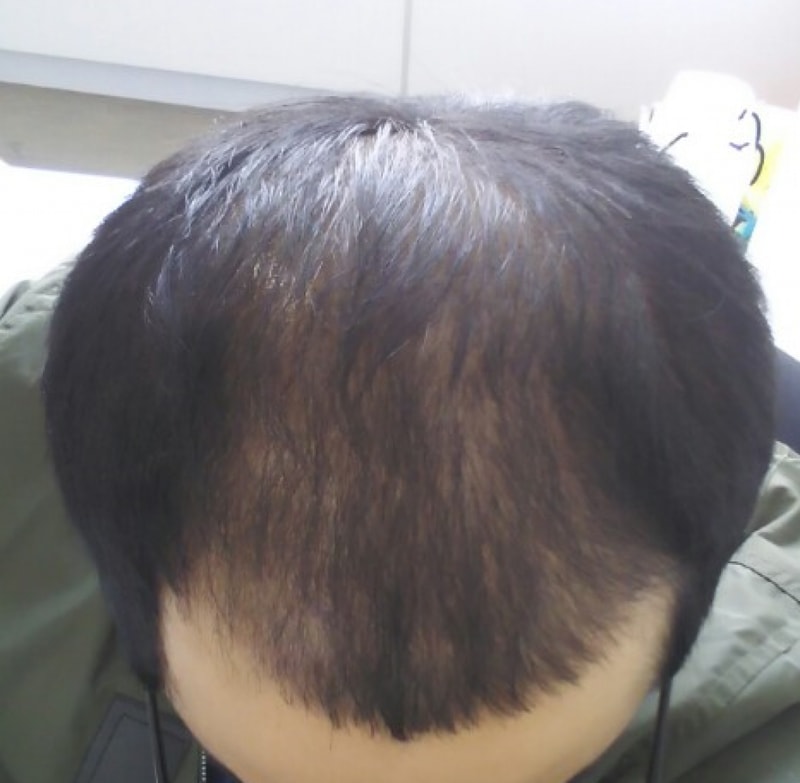 제목 없음1.png