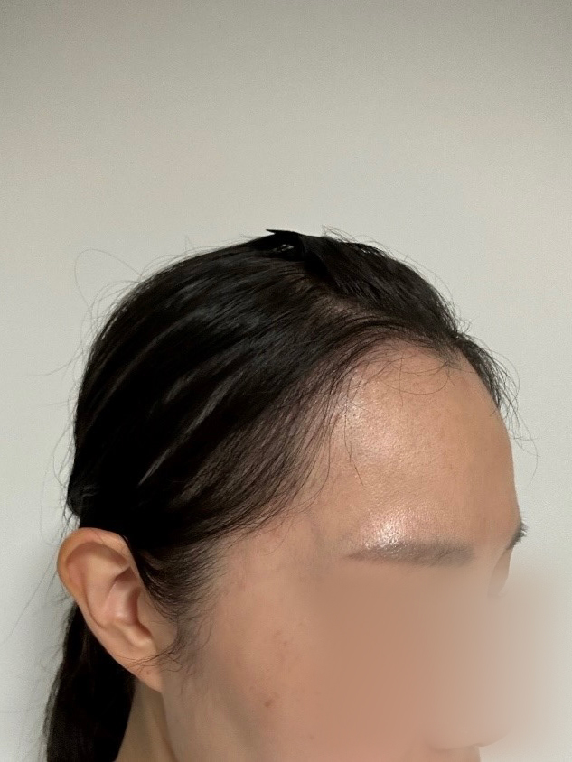 1002 이보람 6.jpg
