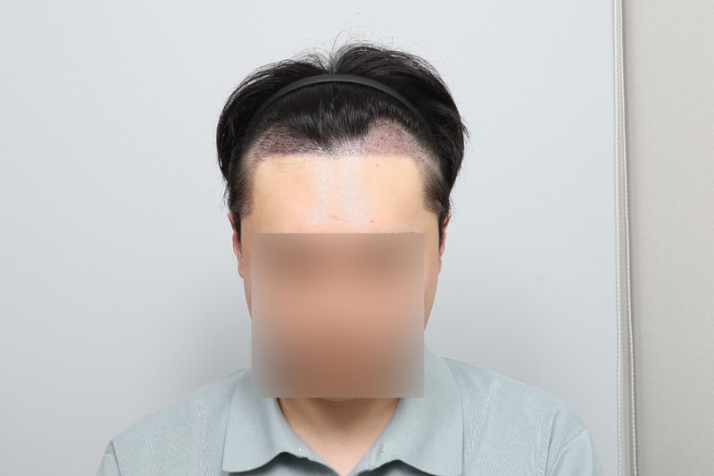 후1.jpg