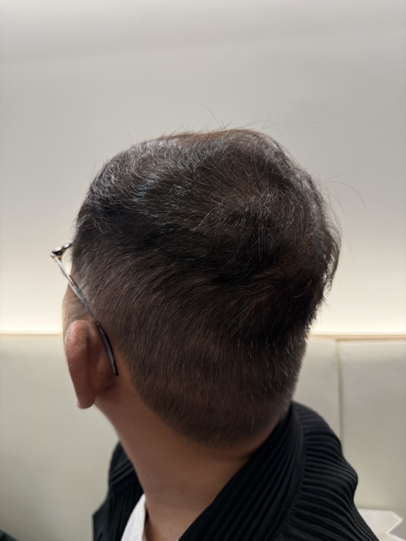 후4.jpg