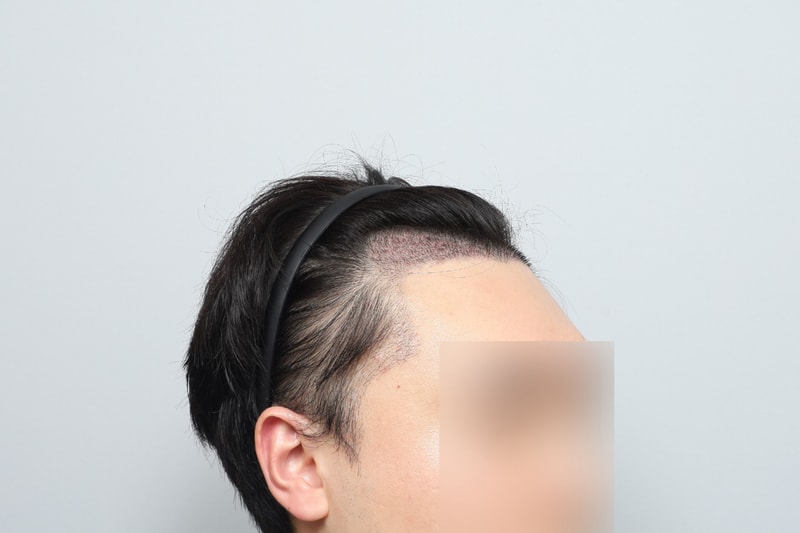 후2.jpg