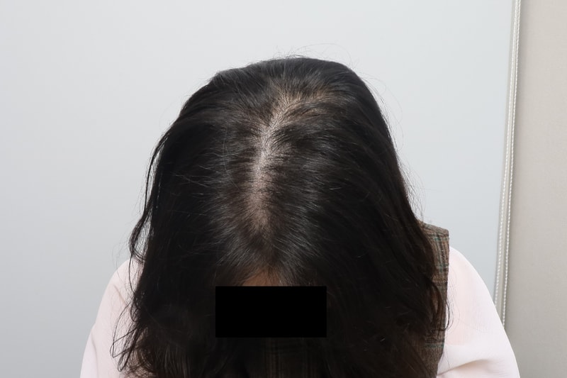 후3.jpg