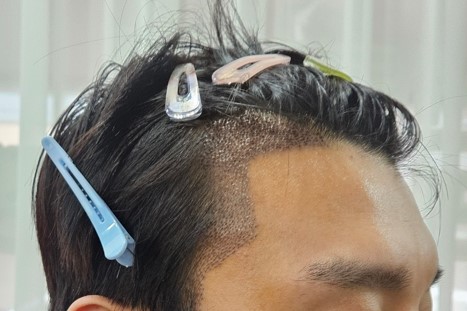 ㅁㄴㅇ.jpg