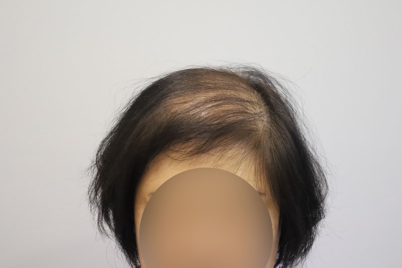 w1.jpg