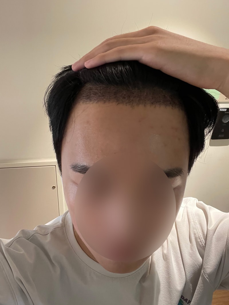 99.jpg