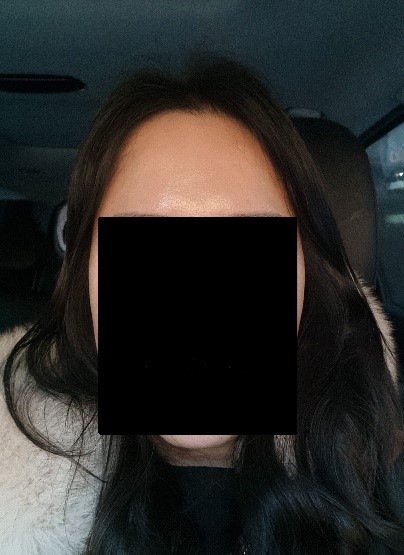 후1.jpg