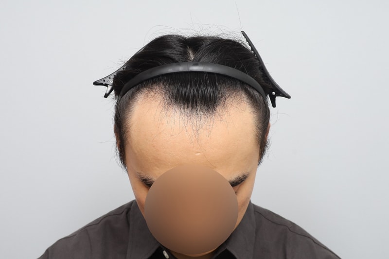 w2.jpg