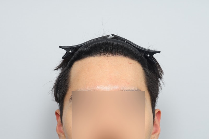 후3.jpg