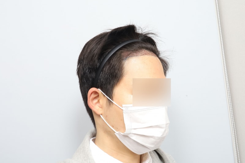 후3.jpg