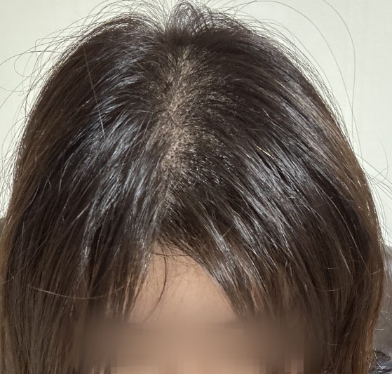 0807_이해인_3.jpg