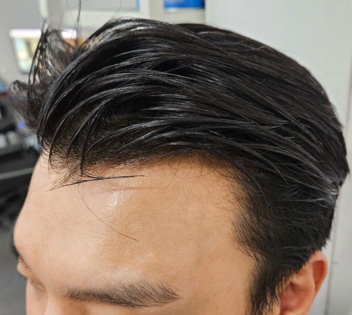 수술전.jpg