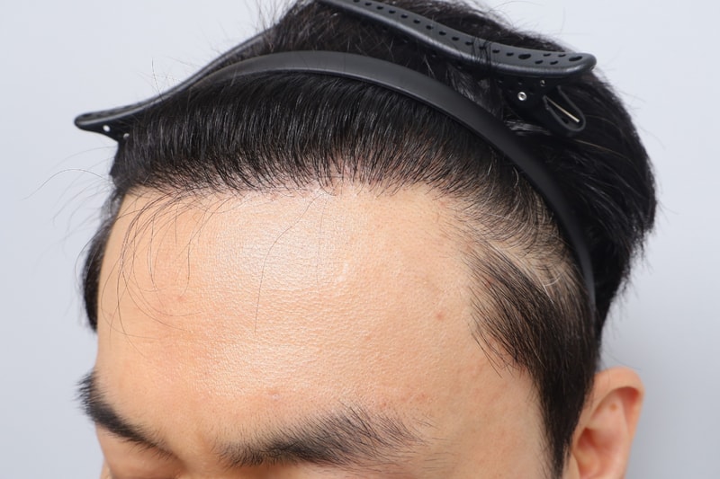 99.jpg