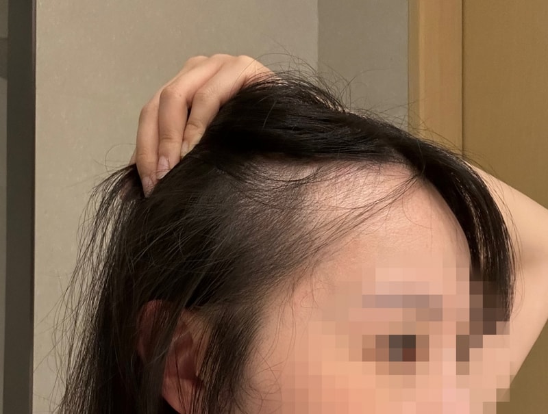 이보람 0704 2.jpg