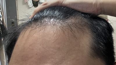 캡처.JPG