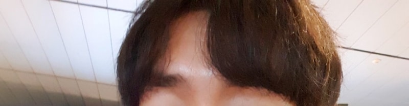 수술후2.jpg