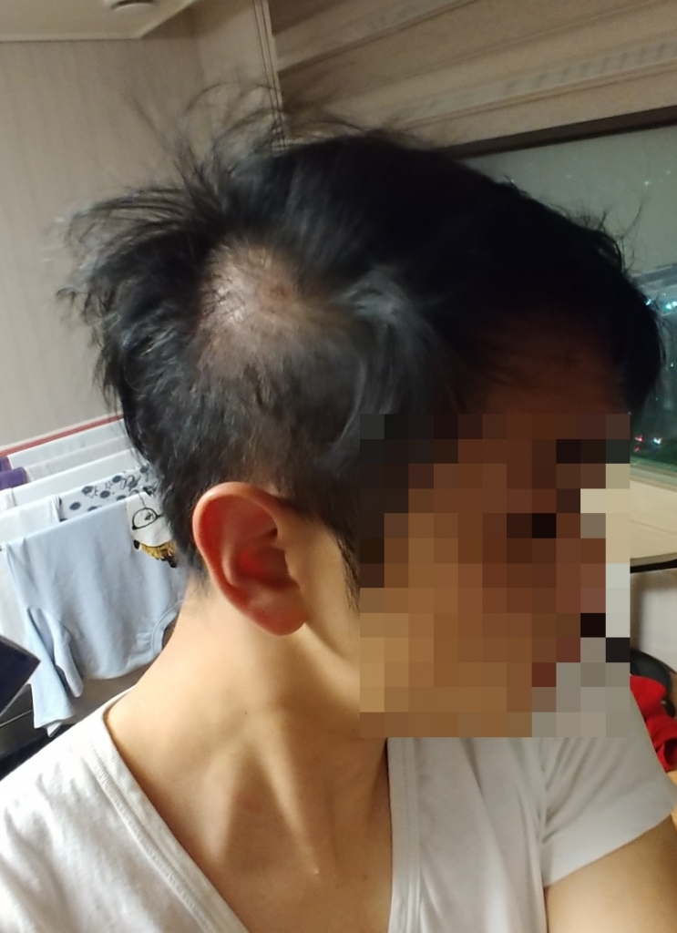 3개월차 되어가는데...이거 정상적인건가요?