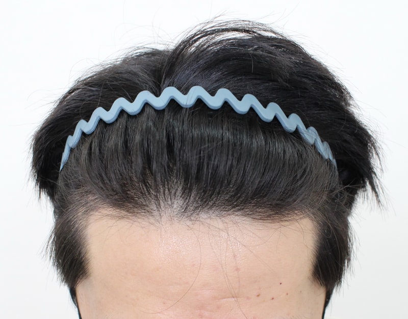 후1.JPG
