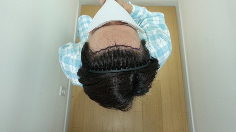 before.jpeg