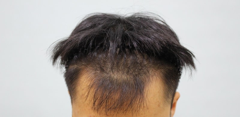 수술전 전면부.jpg