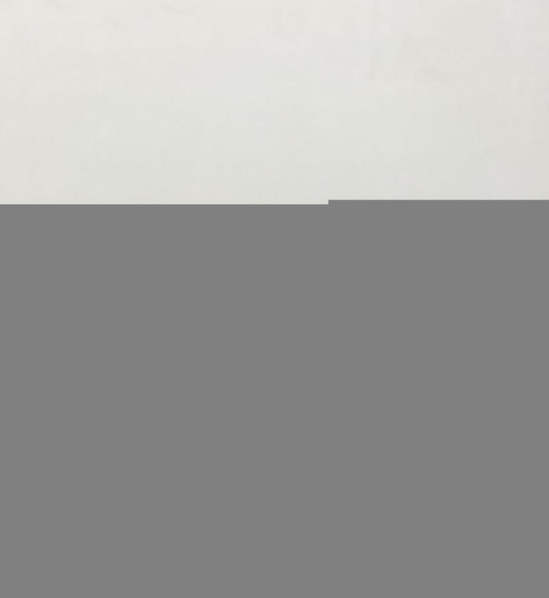 모재성에서 모발이식 했어요