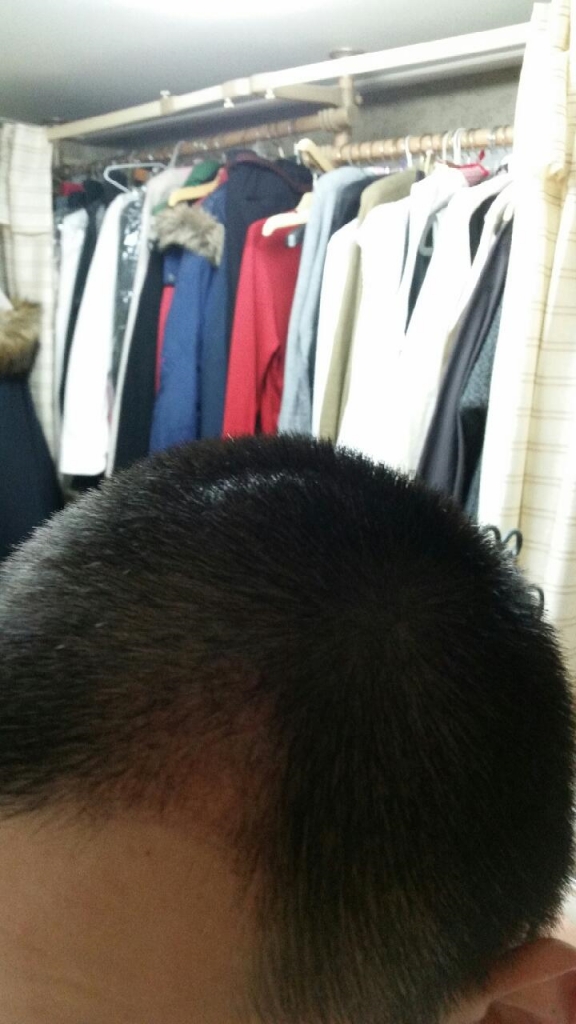 30일차 우측.png