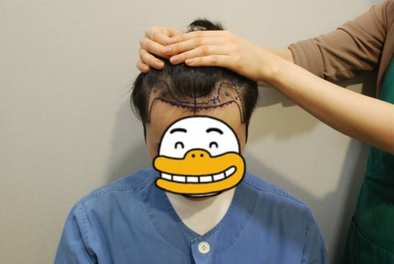 이식 디자인.jpg