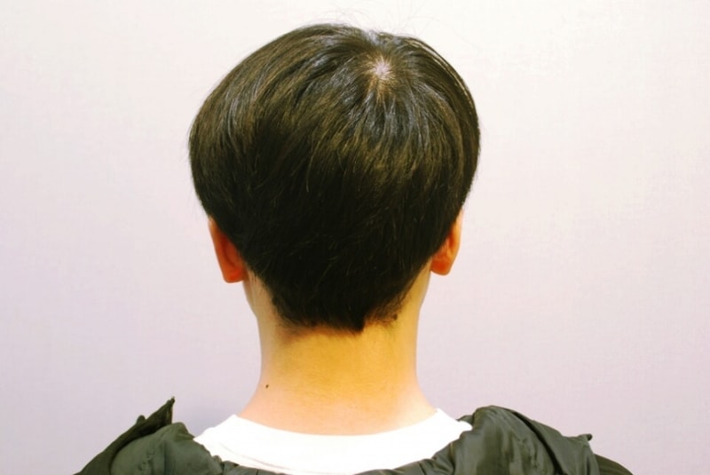 후두.jpg