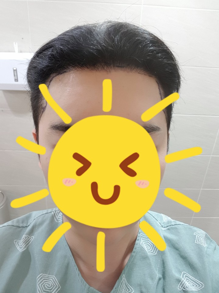 다나 3번째 재수술..수술~회복~경과 지긋지긋하군요.