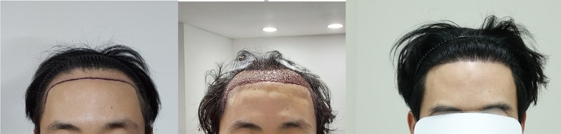 앞.jpg