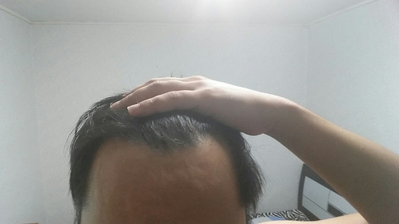 수술전 (4).jpg
