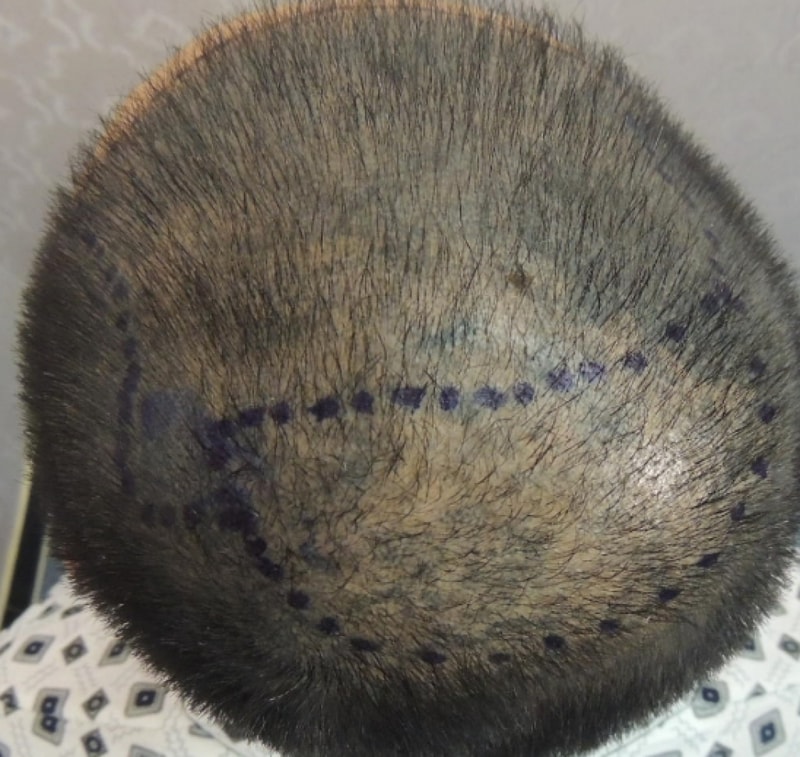 2차  모습.PNG