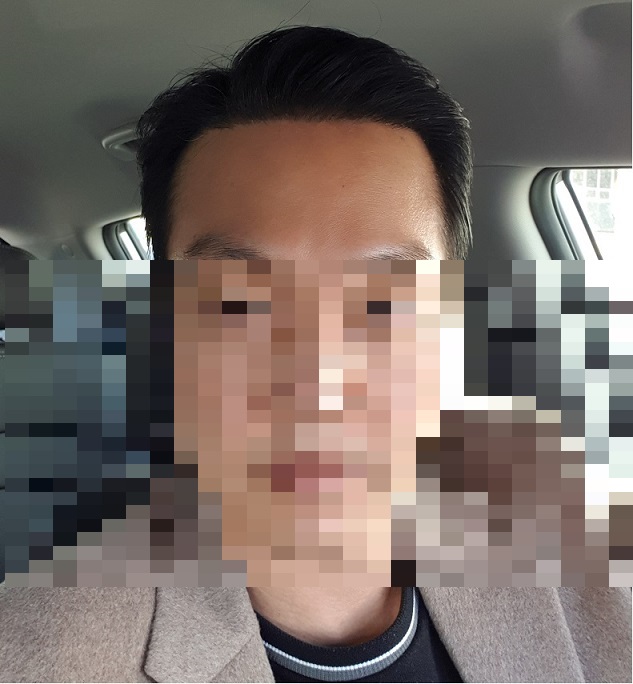 수술 6개월차.jpg