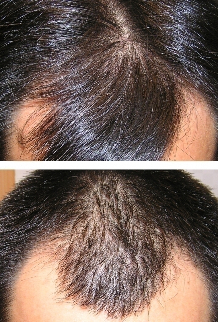 hairmax.jpg