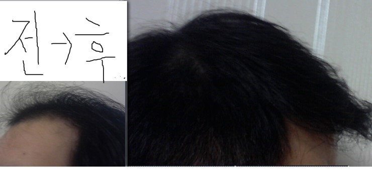 10개월 옆면.jpg