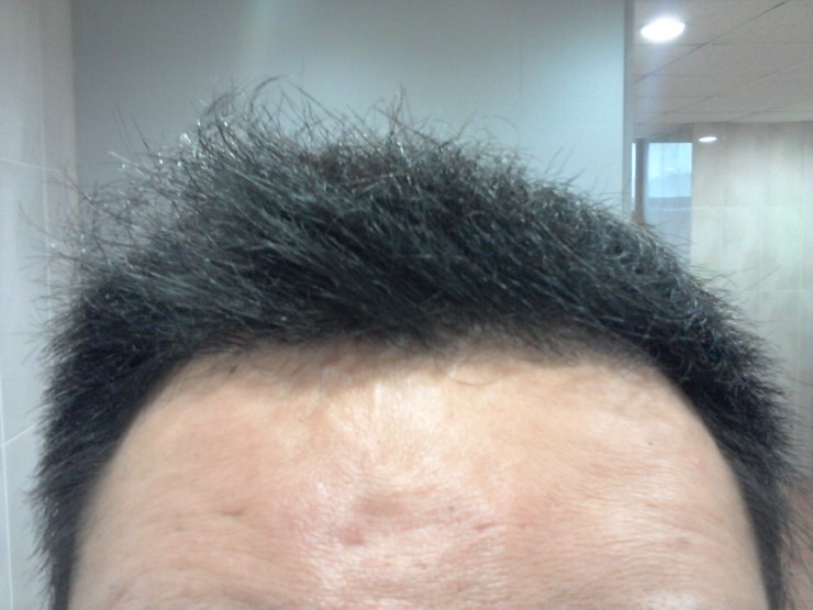 5개월 정면.jpg
