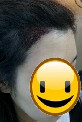 당일.jpg