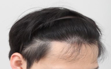 [크기변환]20190131_11개월_우.JPG