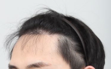 11개월차 근황입니다. 오랜만이네요
