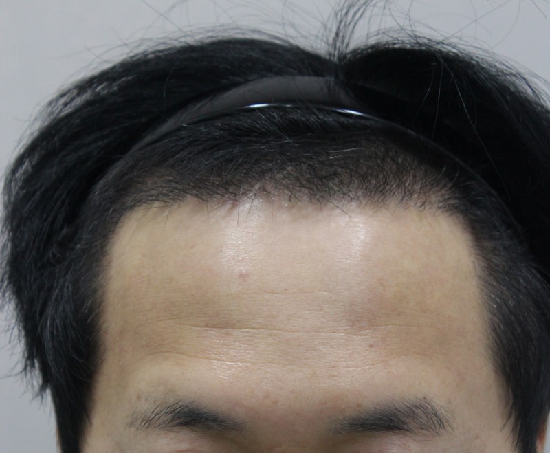 100일차 병원갔다왔어요
