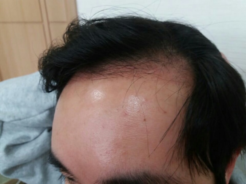 KakaoTalk_Moim_5SdY6oNQM3YzpeGHD9iHpfdYd0VRaW.jpg