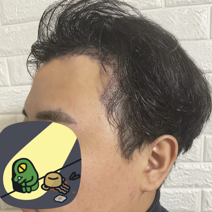 후 왼.jpg