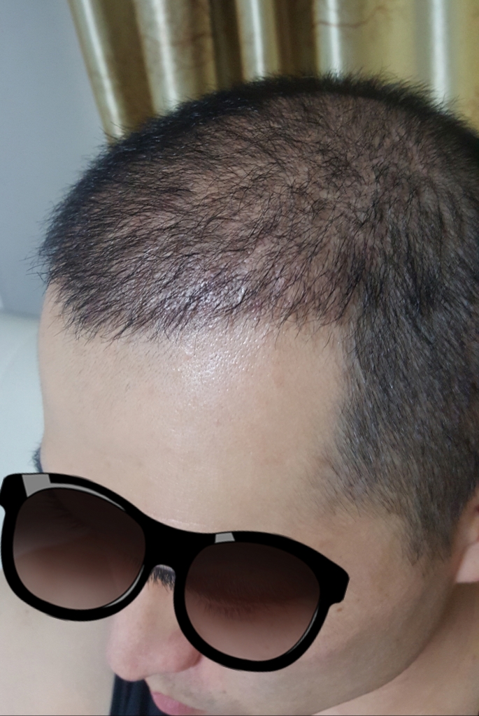 20170816_022226.jpg