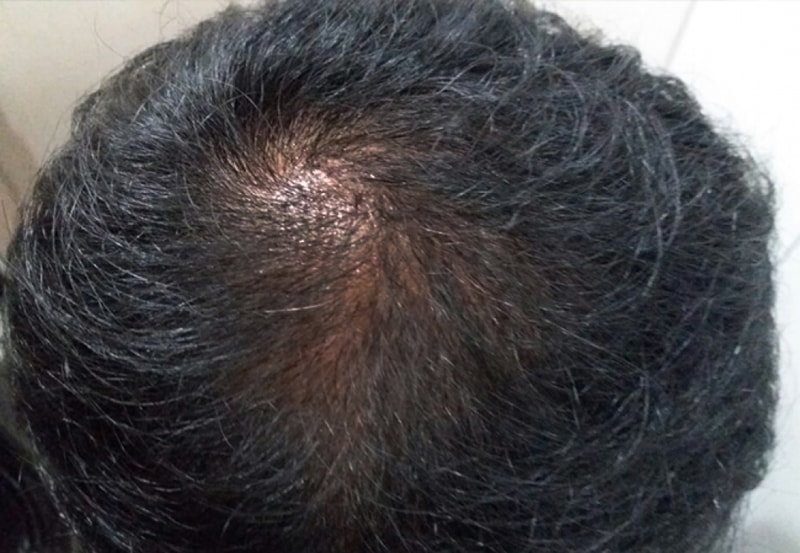 IMG_5664.JPG