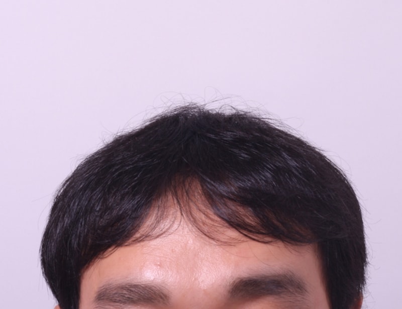 수술후.jpg