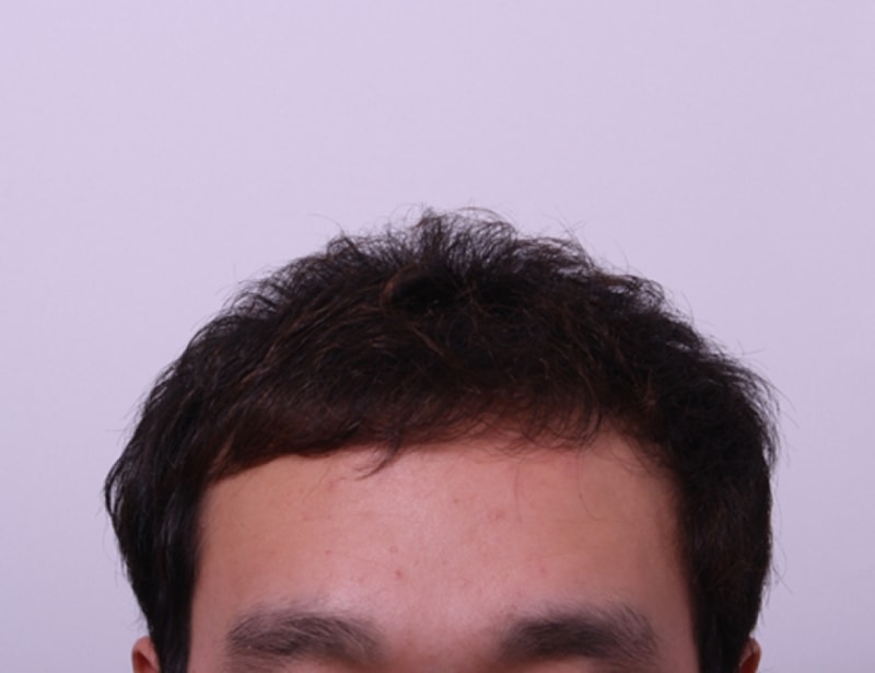 수술전.jpg