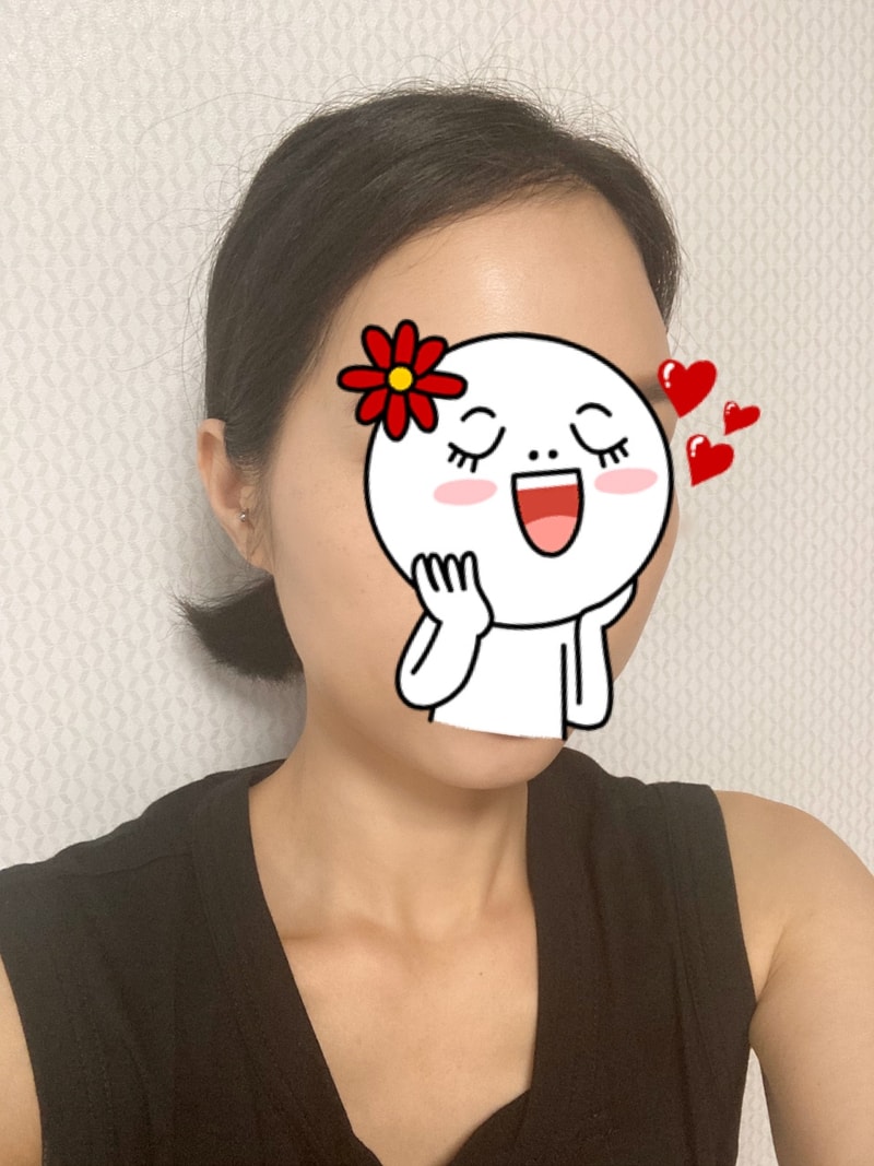 다나에서 수술했어요.2개월~